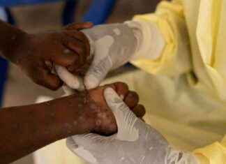 Niveau d’alerte sanitaire mondiale le plus élevé déclenché par l’OMS news-15082024-062729