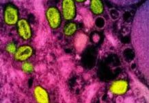 Résurgence des cas de mpox en Afrique : Ce que l’on sait news-16082024-005630