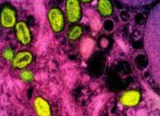 Résurgence des cas de mpox en Afrique : Ce que l’on sait news-16082024-005630