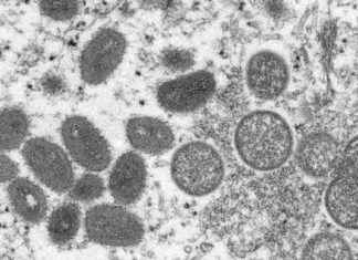 Contrôles aux frontières renforcés par la Chine : cas détecté au Pakistan news-16082024-130015